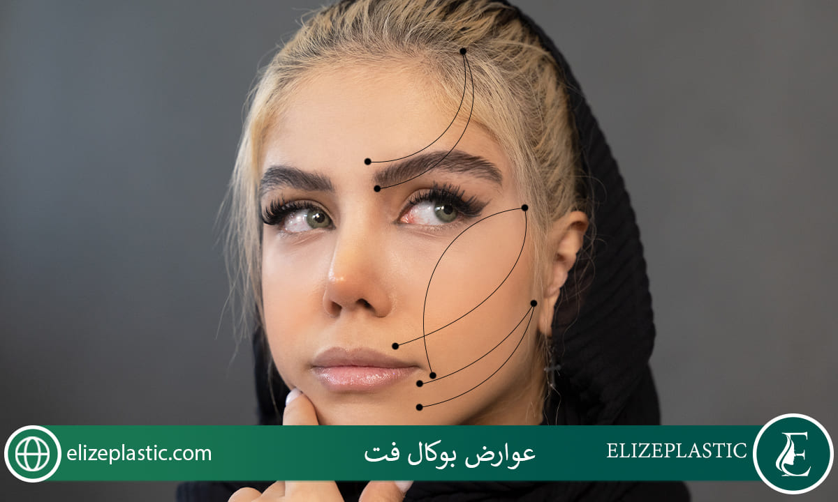  عوارض بوکال فت